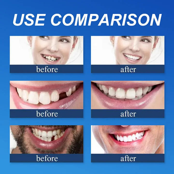 🦷  𝐈𝐦𝐦𝐞𝐝𝐢𝐚𝐭𝐞 𝐝𝐞𝐧𝐭𝐮𝐫𝐞𝐬 - 𝐰𝐞𝐚𝐫𝐚𝐛𝐥𝐞 𝐢𝐧 𝐣𝐮𝐬𝐭 𝐭𝐡𝐫𝐞𝐞 𝐦𝐢𝐧𝐮𝐭𝐞𝐬 | 𝐒𝐦𝐢𝐥𝐞 𝐰𝐢𝐭𝐡 𝐂𝐨𝐧𝐟𝐢𝐝𝐞𝐧𝐜𝐞🔥