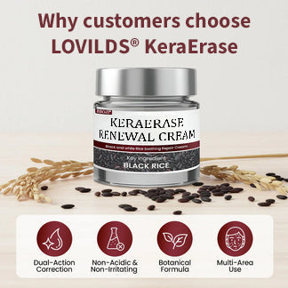 ✅Flash Sale - KeraErase Dual-Action Renewal Cream