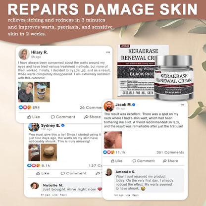 ✅Flash Sale - KeraErase Dual-Action Renewal Cream
