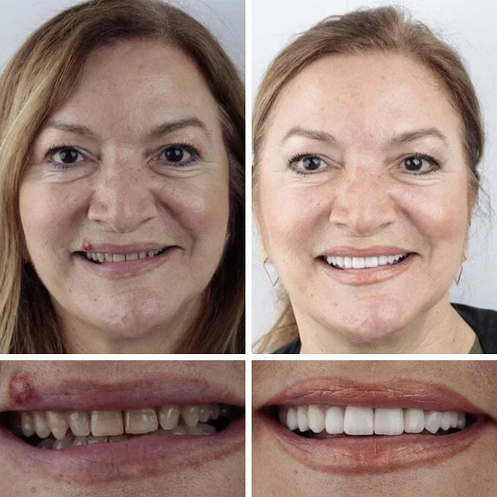 🦷  𝐈𝐦𝐦𝐞𝐝𝐢𝐚𝐭𝐞 𝐝𝐞𝐧𝐭𝐮𝐫𝐞𝐬 - 𝐰𝐞𝐚𝐫𝐚𝐛𝐥𝐞 𝐢𝐧 𝐣𝐮𝐬𝐭 𝐭𝐡𝐫𝐞𝐞 𝐦𝐢𝐧𝐮𝐭𝐞𝐬 | 𝐒𝐦𝐢𝐥𝐞 𝐰𝐢𝐭𝐡 𝐂𝐨𝐧𝐟𝐢𝐝𝐞𝐧𝐜𝐞🔥