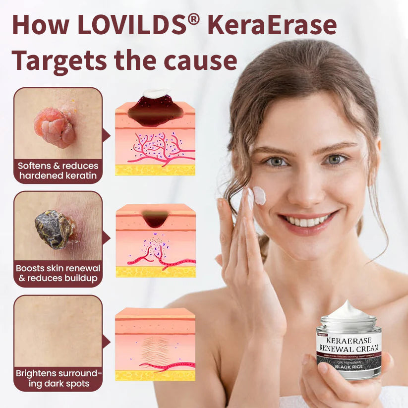 ✅Flash Sale - KeraErase Dual-Action Renewal Cream